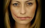Scarification at home How to make a beautiful scar on the face