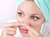 Puncte negre pe nas - comedoane și acnee: cauze și metode de eliminare