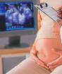 Колко скрининга се правят по време на бременност
